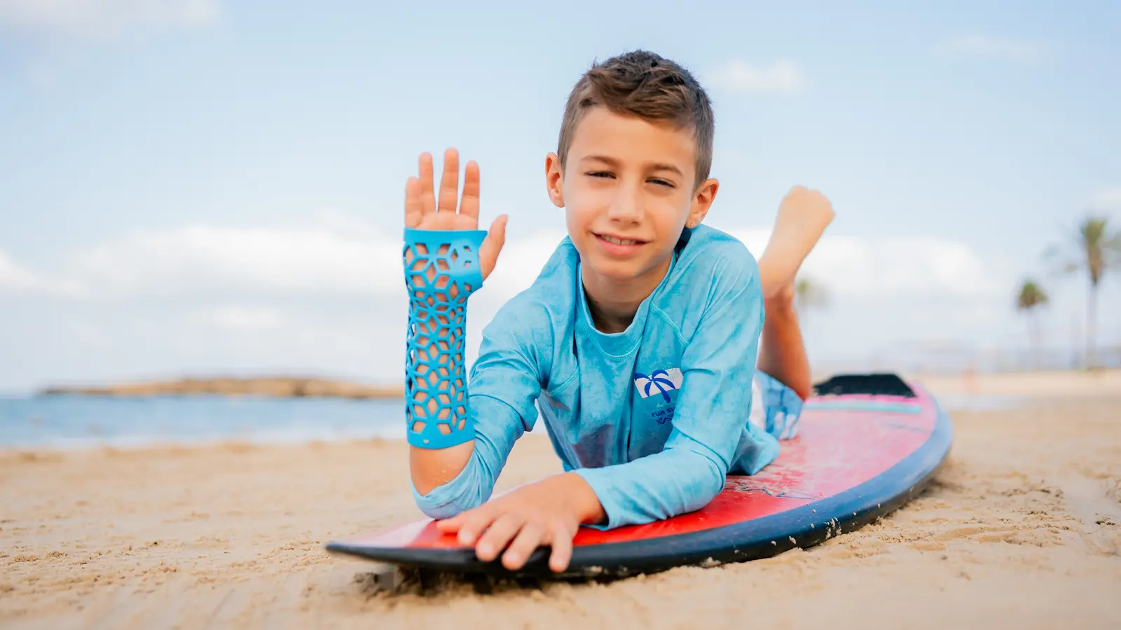 A boy on a surfboard wearing a Gero3D cast