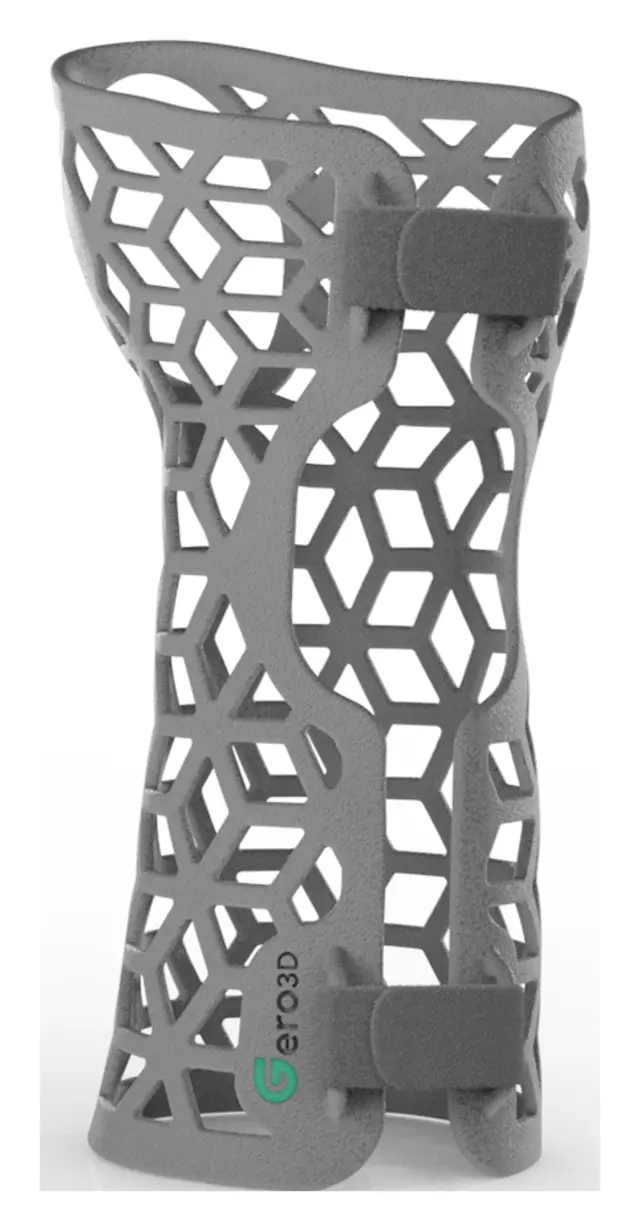 Short Arm Cast